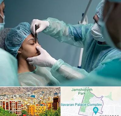 عمل بینی ارزان در نیاوران 