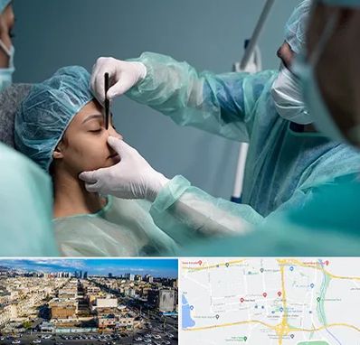 عمل بینی ارزان در شهرک راه آهن 