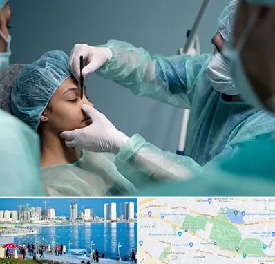 عمل بینی ارزان در چیتگر 