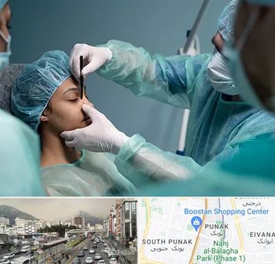 عمل بینی ارزان در پونک 