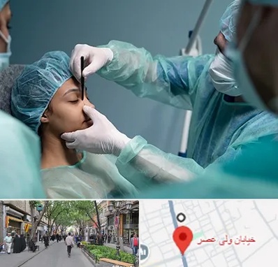 عمل بینی ارزان در ولیعصر شهریار