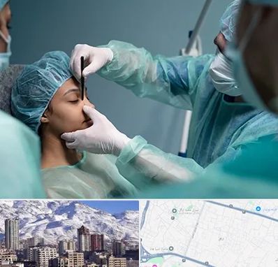 عمل بینی ارزان در ازگل