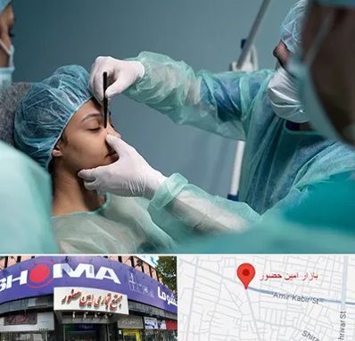 عمل بینی ارزان در امین حضور