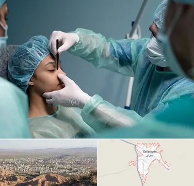 عمل بینی ارزان در اسفراین