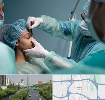 عمل بینی ارزان در توانیر