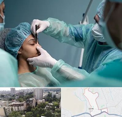 عمل بینی ارزان در اوین