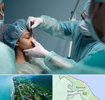 عمل بینی ارزان در رامسر