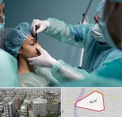 عمل بینی ارزان در آذری