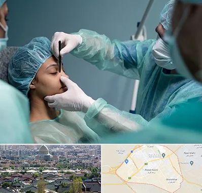 عمل بینی ارزان در رباط کریم