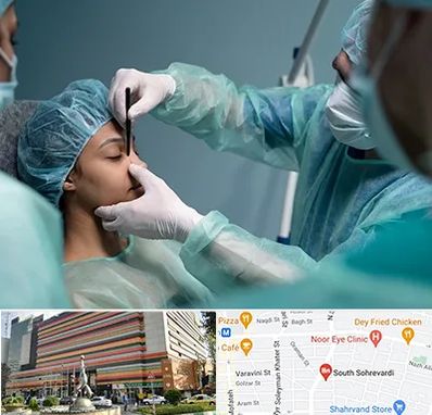 عمل بینی ارزان در سهروردی 