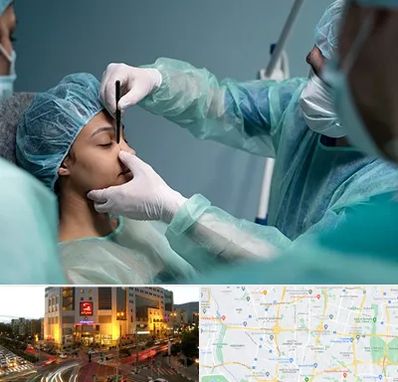 عمل بینی ارزان در جنت آباد تهران 