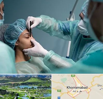 عمل بینی ارزان در خرم آباد