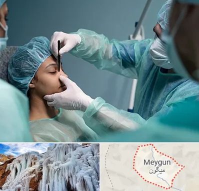 عمل بینی ارزان در میگون