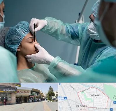 عمل بینی ارزان در پرواز تبریز