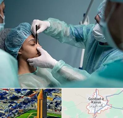 عمل بینی ارزان در گنبد کاووس