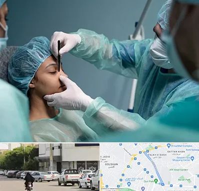 عمل بینی ارزان در قدوسی شرقی شیراز 