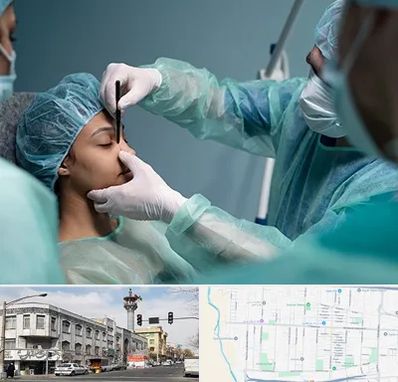 عمل بینی ارزان در 17شهریور