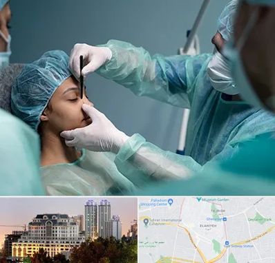 عمل بینی ارزان در فرشته 