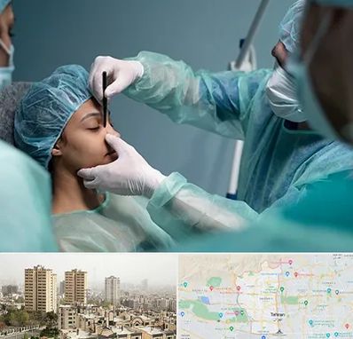 عمل بینی ارزان در منطقه 5 تهران