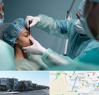 عمل بینی ارزان در شریعتی مشهد 