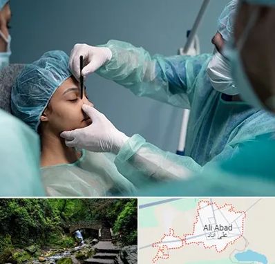 عمل بینی ارزان در علی آباد کتول