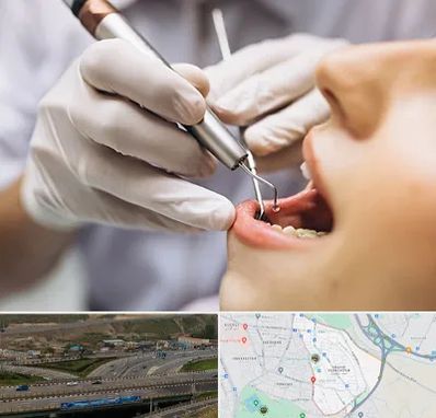 دندانپزشکی ارزان در یاغچیان تبریز