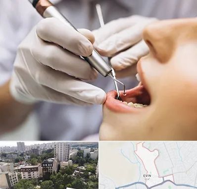 دندانپزشکی ارزان در اوین