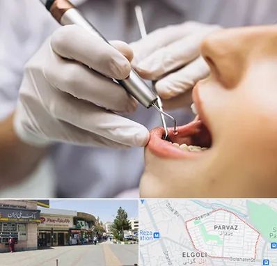 دندانپزشکی ارزان در پرواز تبریز