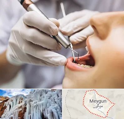 دندانپزشکی ارزان در میگون