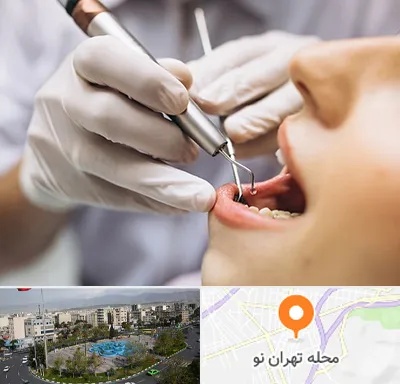 دندانپزشکی ارزان در تهران نو