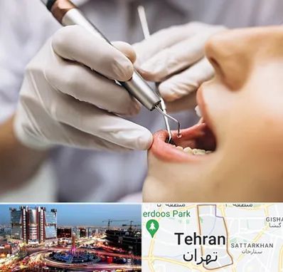 دندانپزشکی ارزان در صادقیه 