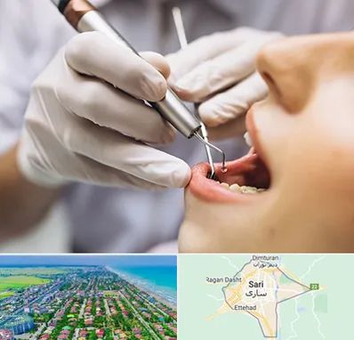 دندانپزشکی ارزان در ساری