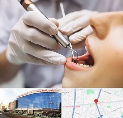 دندانپزشکی ارزان در نصف راه تبریز