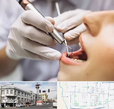 دندانپزشکی ارزان در 17شهریور