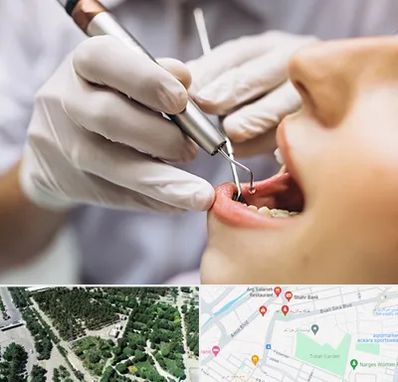 دندانپزشکی ارزان در سالاریه قم