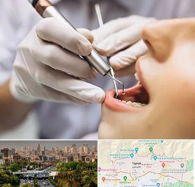 دندانپزشکی ارزان در منطقه 1 تهران 