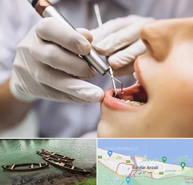 دندانپزشکی ارزان در بندر انزلی