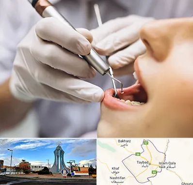 دندانپزشکی ارزان در تایباد