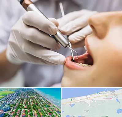 دندانپزشکی ارزان در فریدونکنار