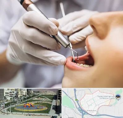 دندانپزشکی ارزان در مرزداران تبریز