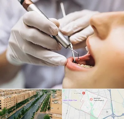 دندانپزشکی ارزان در فاز سه اندیشه