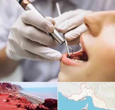 دندانپزشکی ارزان در هرمزگان