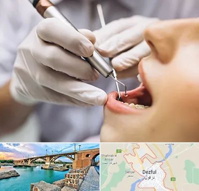 دندانپزشکی ارزان در دزفول