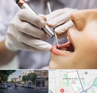 دندانپزشکی ارزان در شهرک ولیعصر