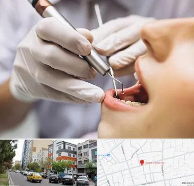 دندانپزشکی ارزان در هفده شهریور تبریز