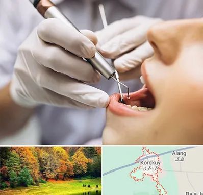 دندانپزشکی ارزان در کردکوی