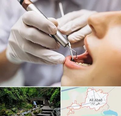دندانپزشکی ارزان در علی آباد کتول