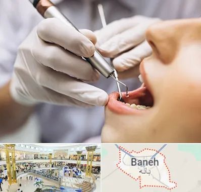 دندانپزشکی ارزان در بانه