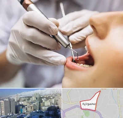 دندانپزشکی ارزان در محمودیه