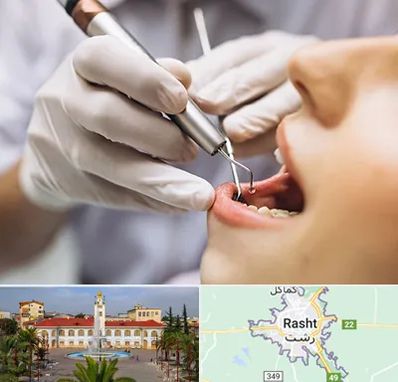 دندانپزشکی ارزان در رشت